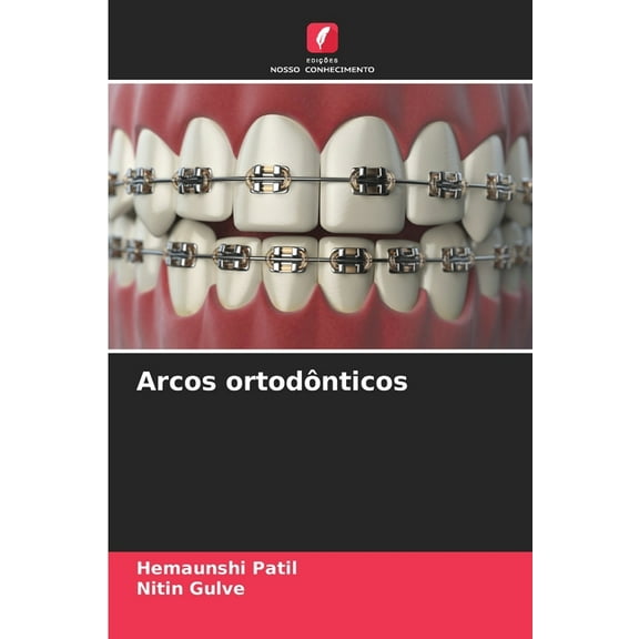 Arcos ortodônticos, (Paperback)