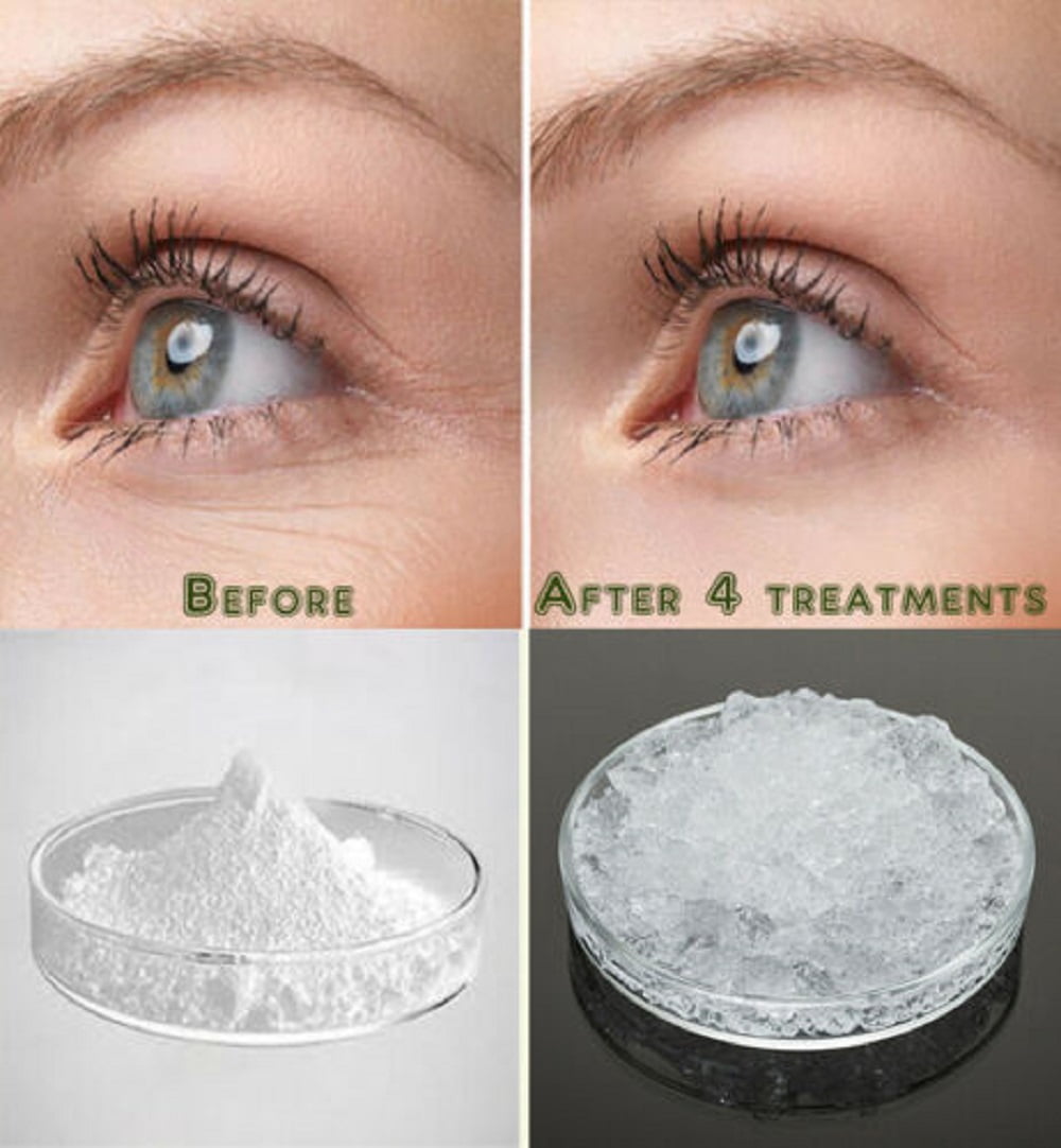Acid Powder Sodium Hyaluronate Pure Hyaluronic for AntiAging Wrinkle
