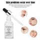 thumbnail image 3 of 30ml Vitamin C Whitening Moisturizing Shrink Pores Face Serum Essence Cream, 3 of 4