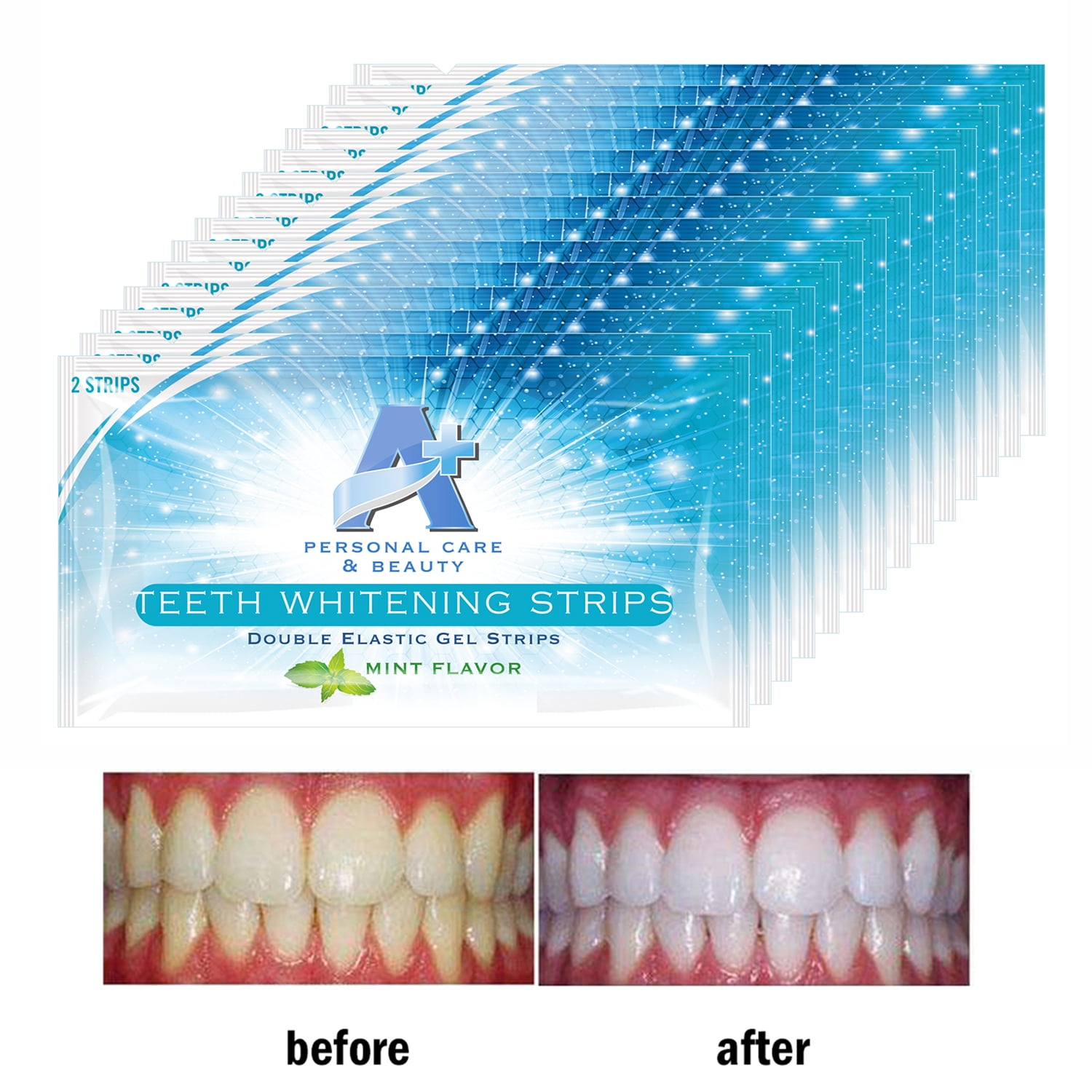 Professional Strength Teeth Whitening Strips Whitestrips Kit 14
