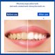 thumbnail image 4 of Tiras de gel blanqueador Vogacara para dientes con tarjeta de color Type3 NO3, 4 of 6