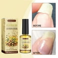 Joykith Jojoba Nail Polish Nail Care Barb Finger Edge Oil Auxiliary