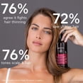 thumbnail image 3 of Apivita Shampoo Tonificante para Mujeres con Cabello Debilitado 250ml - Shampoo natural para la p&eacute;rdida de cabello con complejo t&oacute;nico patentado de hippophae, laurel y prop&o, 3 of 5
