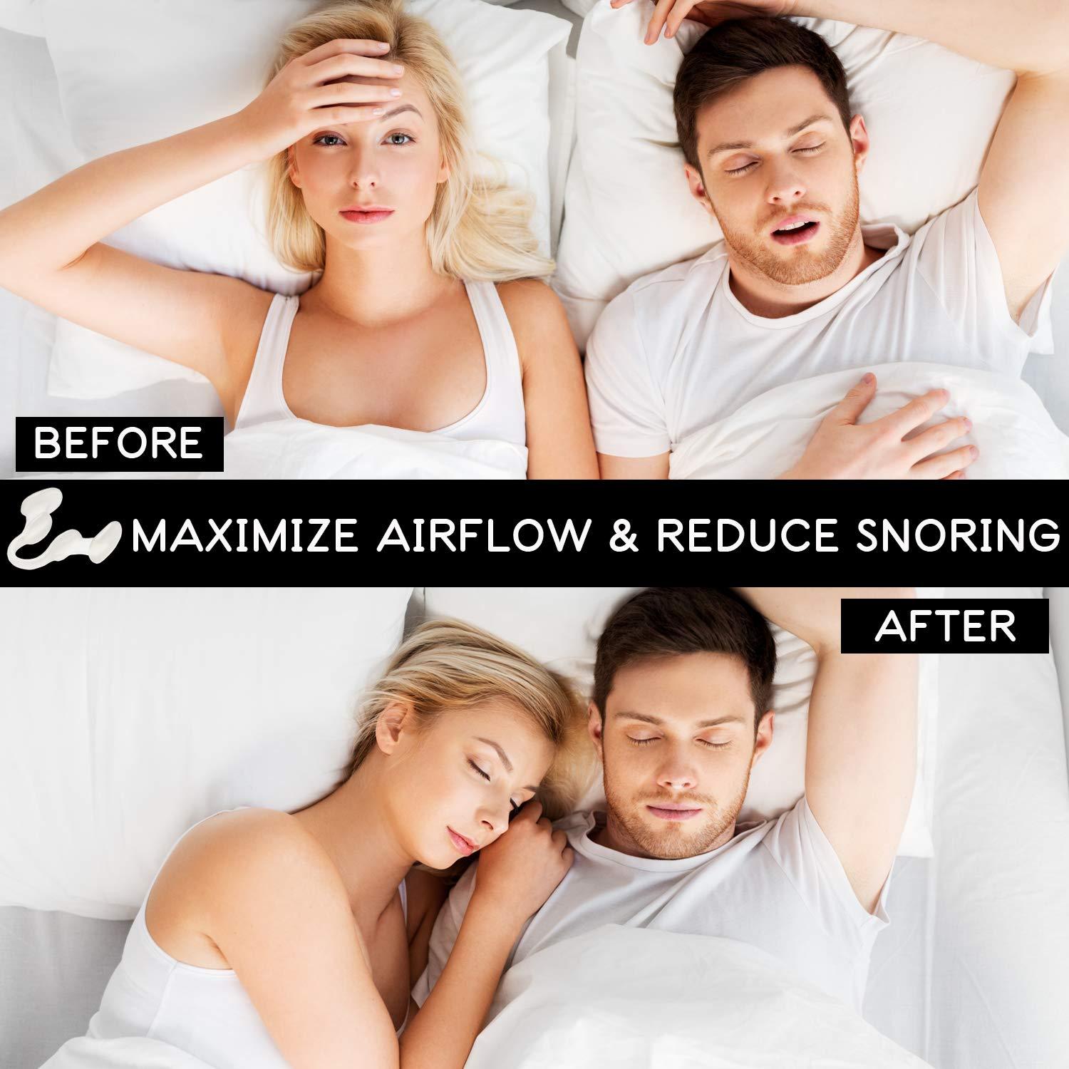 Airmax Nasal Dilator For Better Sleep Natural Comfortable Anti Snoring Device Snoring 3466