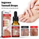 thumbnail image 5 of Suavizante de uñas encarnadas Suero Corrección de uñas Recuperar Aceite Analgésico Ndcxsfigh  Nuevos Originales, 5 of 9