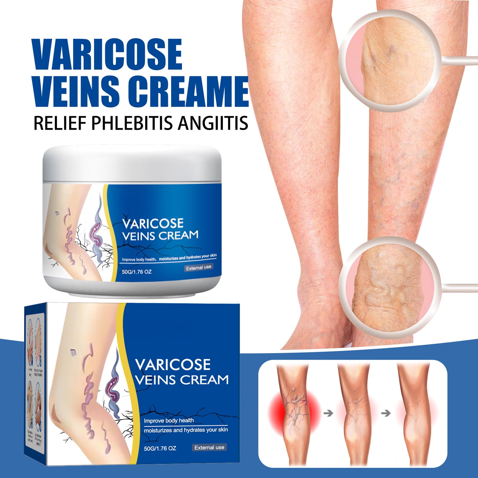 Alvantor Varicose Cream Soothing Vein Relief Leg Cream for Tired Legs 1.76oz