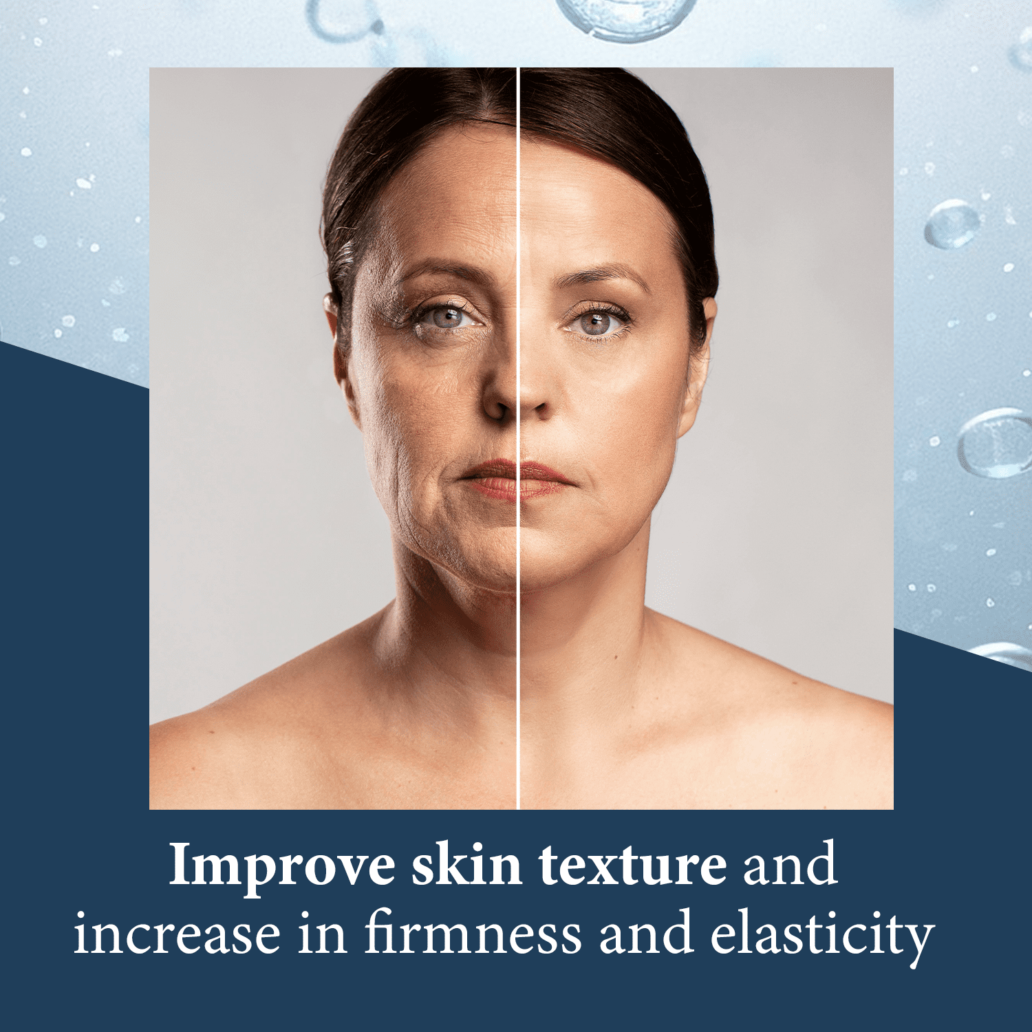 Skin Pro Elite Serum 10 - Natural Anti Aging Eye Serum and Anti Wrinkle Treatment - Eye Bags and Dark Circles Remover with Advanced Formulation of Hyaluronic Acid, Collagen, Argireline and Peptides