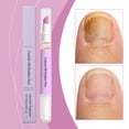 thumbnail image 2 of 2-in-1 Cuticle Oil Pusher Pen, 2026 New Ceramic Cuticle Pusher & Oil Pen, Nail Care Tool for Dry Damaged Nails Hangnails Moisturiz Polish Brighten&nbsp;(purple*2), 2 of 8