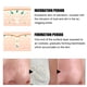 thumbnail image 1 of Limpiador De Poros Mascarilla limpiadora para el acné de 30ml, mascarilla para limpiar los poros, tratamiento para el acné, cuidado de la piel facial Sywqhk Cuidado Belleza, 1 of 7
