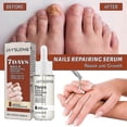 thumbnail image 4 of 1pc Jaysuing 7 Days Nail Repair Essence Element Repair Ingrown Nail Thickening Gray Nail Hand Foot Nail Repair Liquid |, 4 of 5