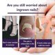 thumbnail image 5 of EELHOE 50Pcs Elastic Ingrown Toenail Correction Stickers Elastic Adhesive Relieve Feet, 5 of 5