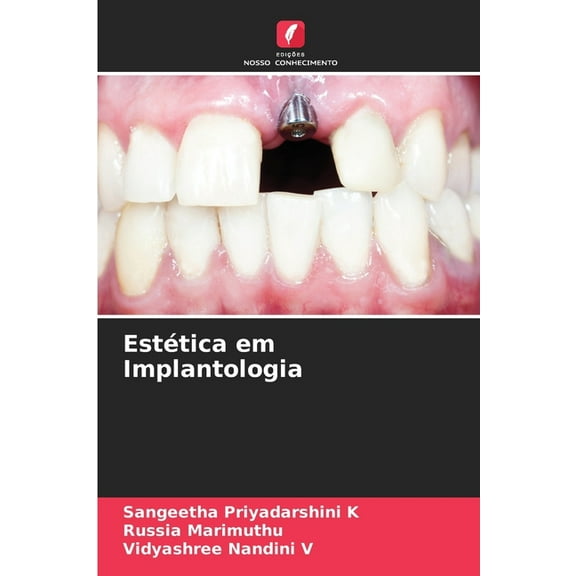 Estética em Implantologia, (Paperback)