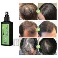 thumbnail image 5 of 3Pcs Growth Nourishing Ginger Spray, Hair Growth Serum Spray Hair Lotion, Regrowth Nourishing Ginger Spray, 5 of 5