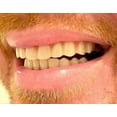 thumbnail image 4 of Instant Smile Comfort Fit Flex Teeth - Upper And Lower Matching Set  Natural Shade! Fix Your Smile At Home Within Minutes!, 4 of 6