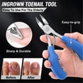 thumbnail image 4 of Nail Clippers for Thick & Ingrown Toenails - Sharp Curved Blade & Non-Slip Handle -Toenail Clippers for Men, Women, and Seniors, 4 of 5
