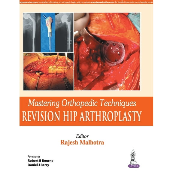 Mastering Orthopedic Techniques: Revision Hip Arthroplasty, (Paperback)