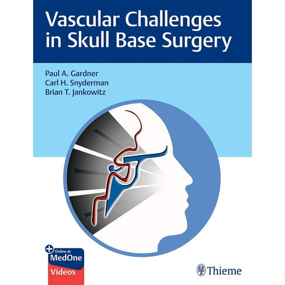 Vascular Challenges in Skull Base Surgery (Hardcover)