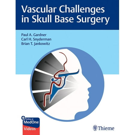 UPC: 9781684200689 | Vascular Challenges in Skull Base Surgery (Hardcover)