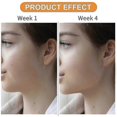 thumbnail image 4 of Jawline Exerciser, Jaw Exerciser For Men And Women, Jaw Trainer, 4 of 4