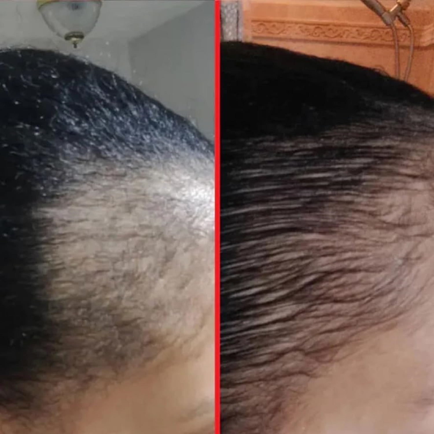 HAIRtamin Advanced Hair Growth Supplement & Gorgeous Travel Serum – 30 Capsules with 15 ml Scalp Serum