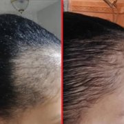 HAIRtamin Advanced Hair Growth Supplement & Gorgeous Travel Serum – 30 Capsules with 15 ml Scalp Serum