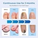 thumbnail image 3 of Light Therapy Device Nail Fungus, Nail Fungus Treatment Device, Highly Efficient Nail Fungus Cold Laser Therapy, Home Use Nails Cleaning Device, 3 of 5