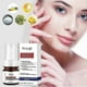 thumbnail image 3 of Whitening and Removing Essence, Anti-Spot Serum, Vitamin C Freckle Solution, Vitamin C Crema 2025, 3 of 4