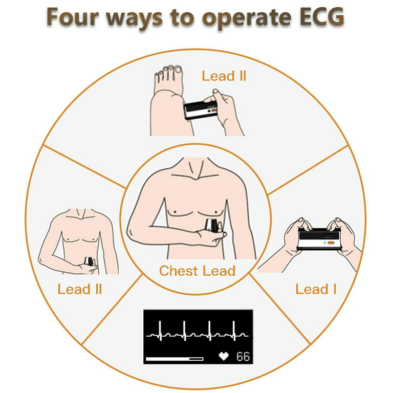 Wellue Smart Blood Pressure Monitor (BP + ECG)