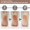 thumbnail image 4 of Foot File Callus Remover - Pedicure Stainless Steel Colossal Foot Grater Scrubber Pedicure Tools, 4 of 9