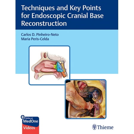 UPC: 9781684202324 | Techniques and Key Points for Endoscopic Cranial Base Reconstruction (Hardcover)