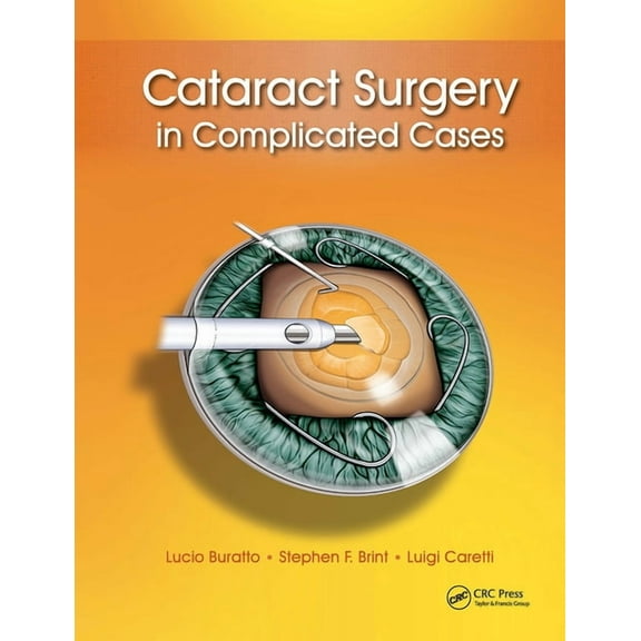 Cataract Surgery in Complicated Cases, (Hardcover)