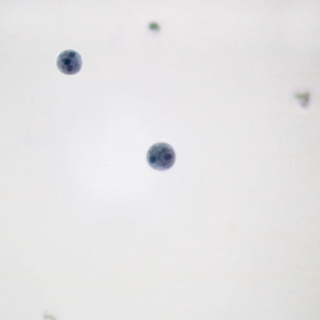 Entamoeba Histolytica Cysts  Smear Microscope Slide price history on PriceWatchPro