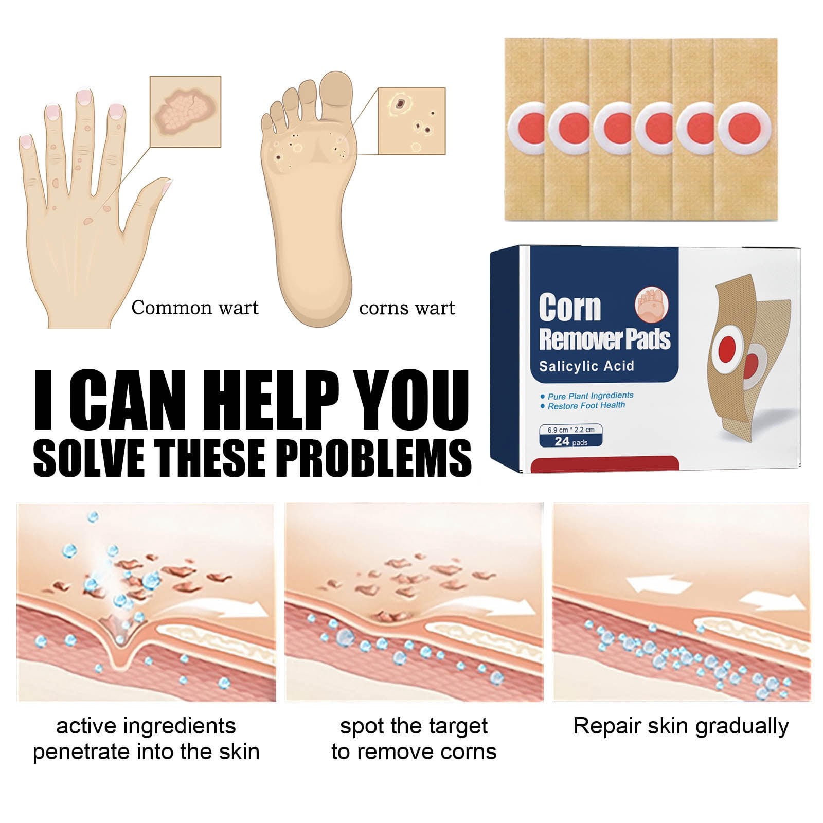 Alvantor Corn Removal Pads for Toes, Extra Strength Corn & Callus Repair Patch, 24pads
