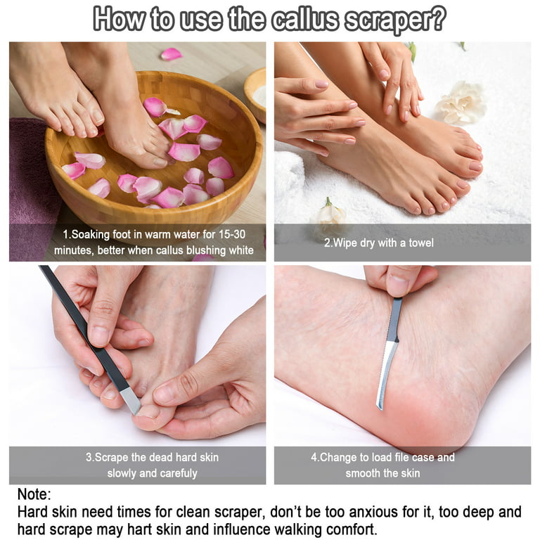 Callus Remover for Feet, Pedicure Knife Foot Sharpeners, Pedicure Knife, Foot  Knife Hard Skin Remover, Professional Home Foot Scraping Knife, Stainless  Steel Dead Skin Calluses Remover Scraper