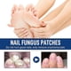 thumbnail image 2 of Formula Fungal Nail Paronychia Treatment Gel, Toenail Fungus Treatment, Extra Strength Nail Repair Solution For Finge, 2 of 5