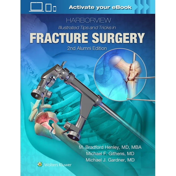 Harborview Illustrated Tips and Tricks in Fracture Surgery, (Hardcover)
