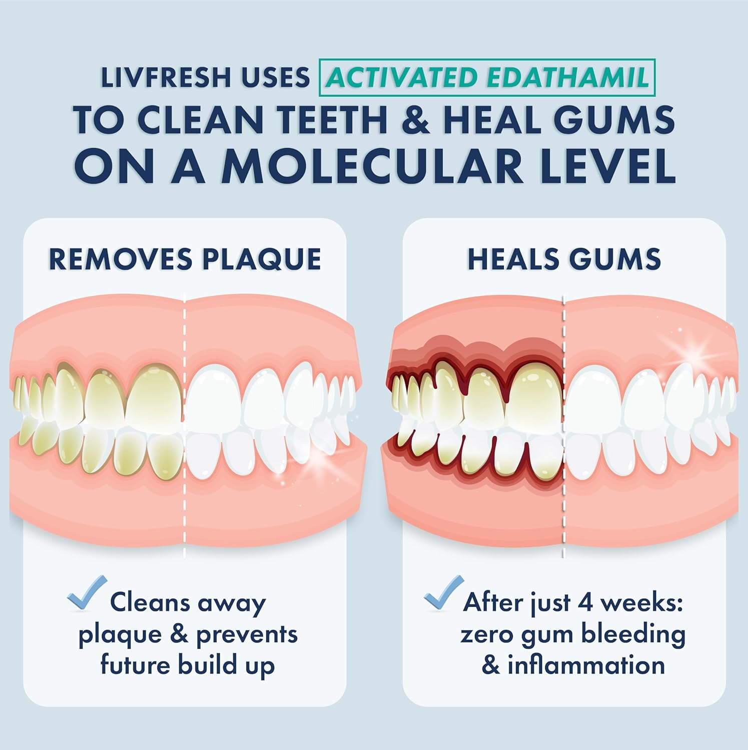 LIVFRESH Dental Gel by Livionex - Clinically Proven to Remove Plaque 250% Better (Color-Free + Mild Peppermint + Non-Foaming)