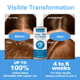 thumbnail image 7 of Coal Tar Anti Dandruff Shampoo Scalp Care for Itchy Flaky Skin Oil Control Hair Cleanser 10.14 fl oz, 7 of 7