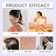 thumbnail image 3 of ExquisiteLavender/Ginger Massage Essential Oil, Massage Oil for Massage Therapy, Sore Muscle Arnica Oil & Lavender Oil Relaxing Massage Oil for Date N, 3 of 4
