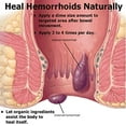 thumbnail image 5 of Hemorrhoid & Piles Ointment, Salve/Balm, Treatment, Anal Fissure, Pain, Swelling, 5 of 8