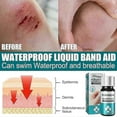 thumbnail image 2 of Medical Glue For Cuts, Fast-drying & Breathable Liquid Skin Bandage, Great For Use On Fingers, 2 of 5