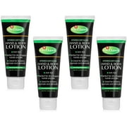 4 Pack Dr. Dans Hydrocortisone Anti Itch Hand and Body Lotion 2.5 oz Each