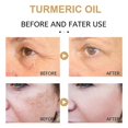 thumbnail image 2 of Crema de cúrcuma, corrector de manchas oscuras, melasma de la piel, suero para eliminar arrugas, antimanchas, 2 of 4