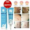 thumbnail image 5 of Limpiador de belleza con cúrcuma El mejor tratamiento de maquillaje Cuidado facial para mujeres Cobertura de la piel Luminesce Naturium Belleza femenina y eliminación de cicatrices Mantiene el rostro, 5 of 5