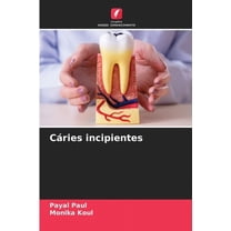 CÃ¡ries incipientes, (Paperback)