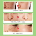thumbnail image 2 of Crema Hidratante Facial Calmante - Aceite de Rosa Mosqueta, Hamamelis, Manzanilla, Aloe, Vitamina E | Hidratante Reparador, Antienvejecimiento, Iluminador | Tarro de 30g | Mantenimiento facial, 2 of 6