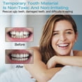 thumbnail image 4 of 2 pares de dentaduras postizas cosméticas, carillas dentales superiores e inferiores, dentaduras postizas instantáneas, carillas de dientes postizos, dentaduras postizas de sonrisa perfecta con caja de almacenamiento para hombres y mujeres JM MX-0134187FYD, 4 of 5