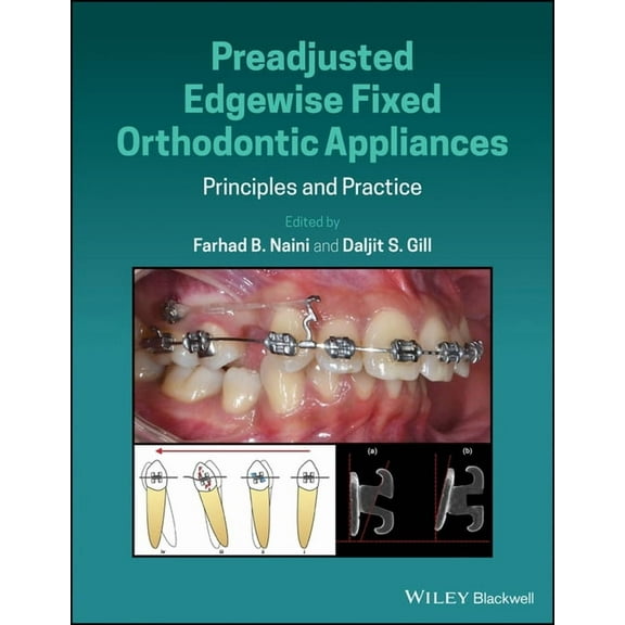Preadjusted Edgewise Fixed Orthodontic Appliances: Principles and Practice (Hardcover)