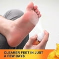 thumbnail image 3 of 3-in-1 Bee Venom Foot Spray for Nail Fungus, Athlete's Foot & Tinea Pedis,Natural Antifungal Treatment,Repairs Cracked Nails & Discoloration, 3 of 4