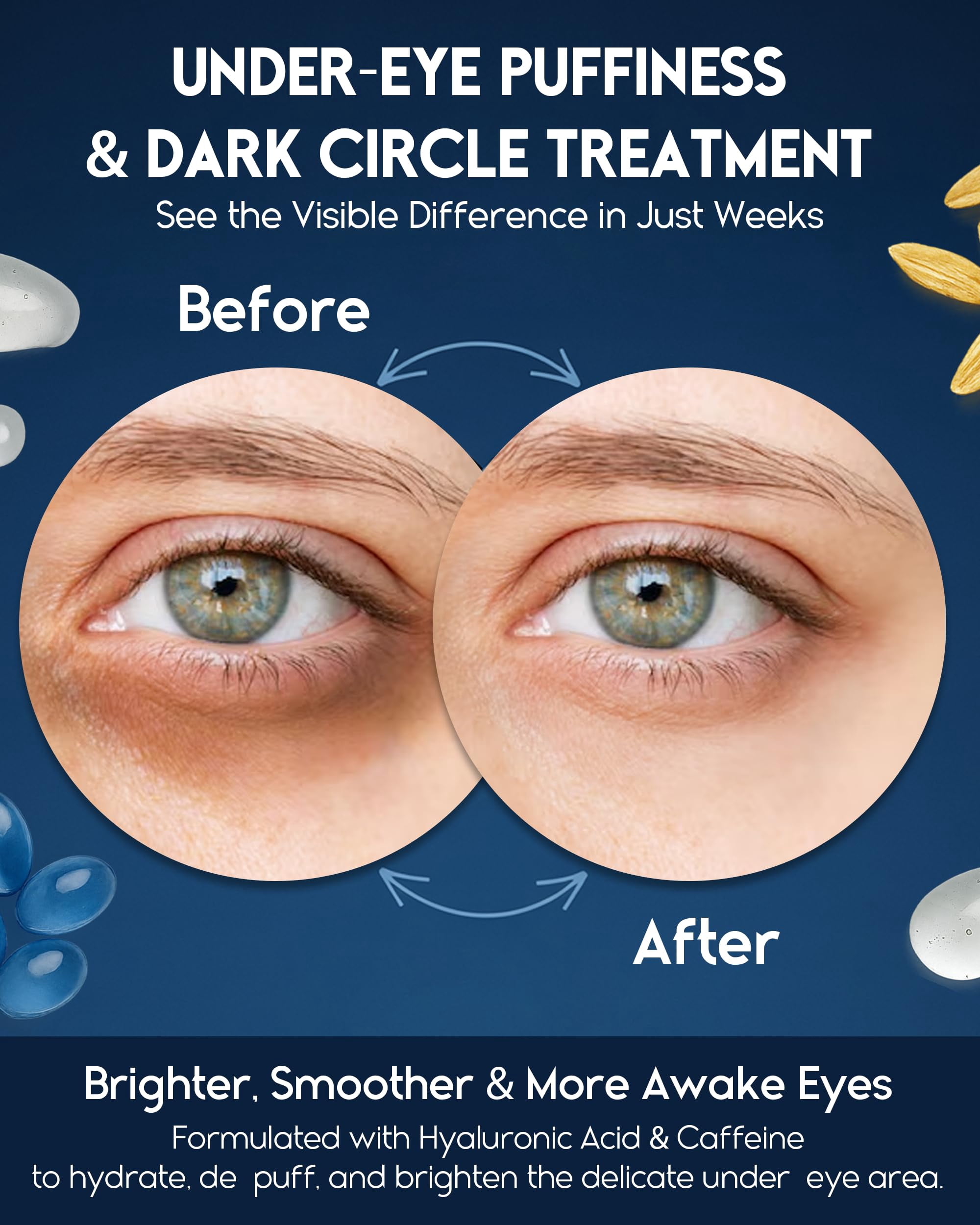 Under Eye Cream for Puffiness and Bags Under Eyes - Eye Bags Treatment for Men & Women - Anti Wrinkle Cream for Dark Circles, Baggy Eyes Treatment for Women with Retinol, Hyaluronic Acid & Caffeine